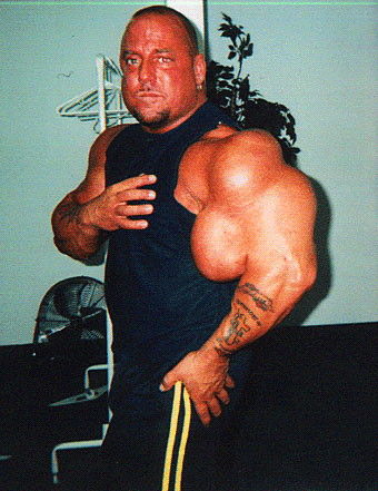 Greg Valentino and his inflated arms